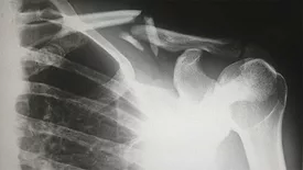 X-Ray