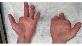 technician-injury.jpg