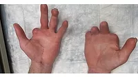 technician injury.jpg technician-injury.jpg
