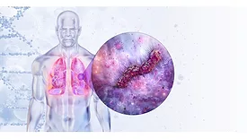 LEGIONELLA.jpg