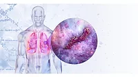 LEGIONELLA.jpg