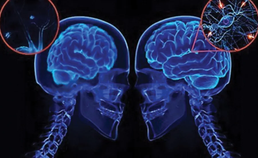 Relative humidity levels play an important part of our brain function