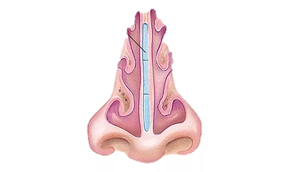 Our noses operate
