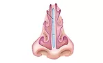 Our noses operate