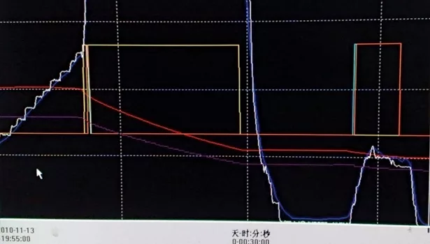 Level measurements