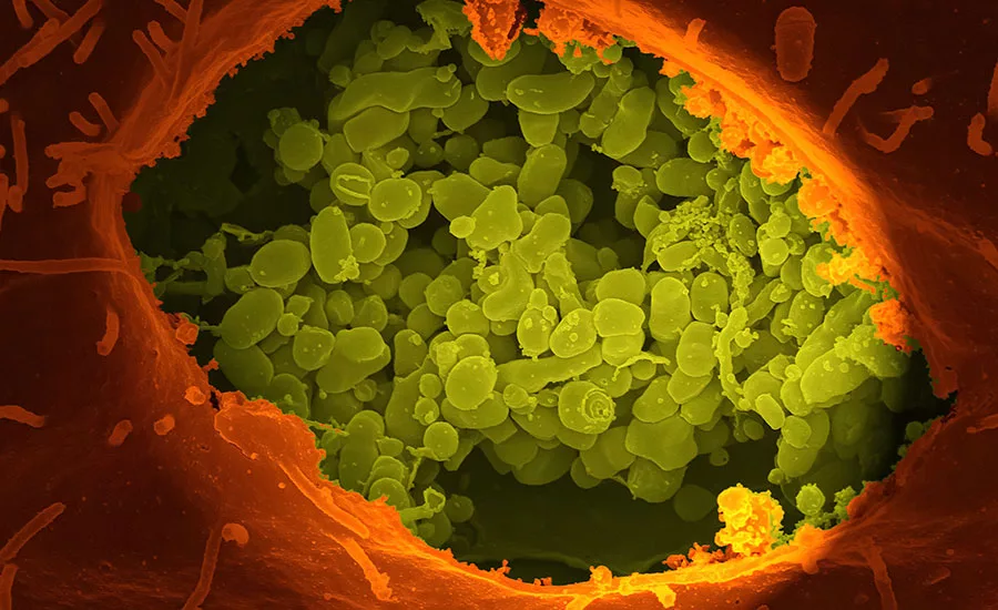 pathogens